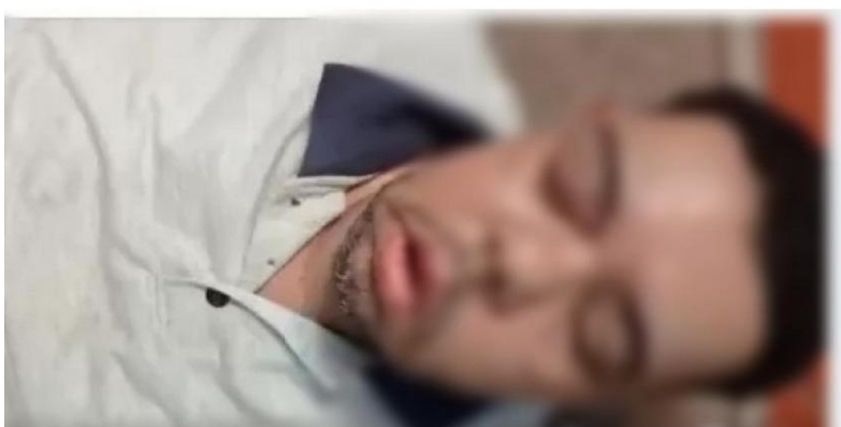 «أحمد» مصاب الفطر الأسود