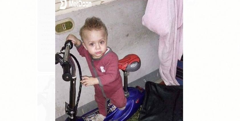 الطفل حسن وائل يفقد بصره بعد الإصابة بمرض في المخ