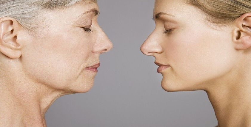 تلف الدماغ عند النساء