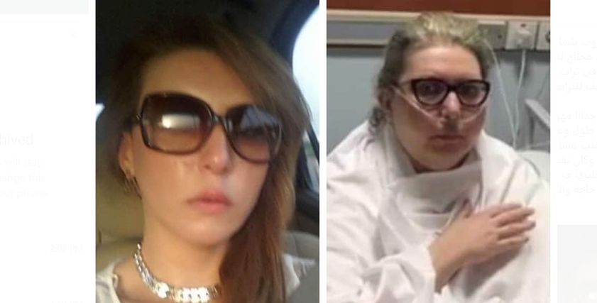 سارة أحمد مريضة الورم العضلي الليمفي