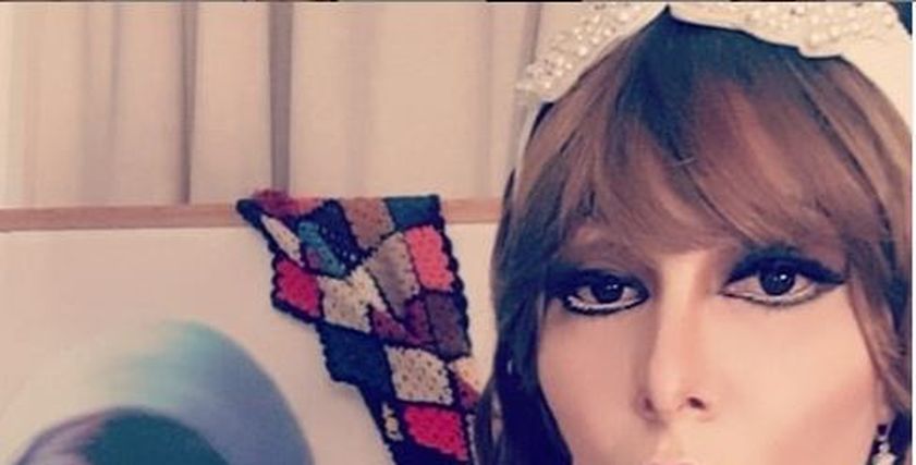 ميريهان حسين تحول وجهها إلى