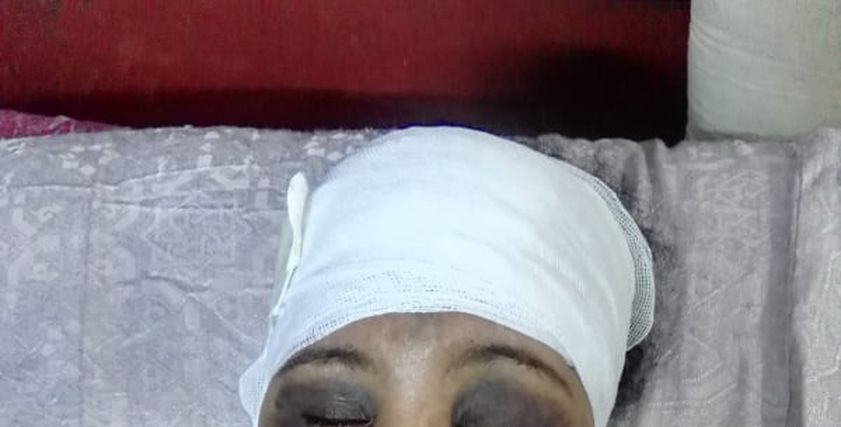 فاطمة بعد الاعتداء عليها من شقيق زوجها