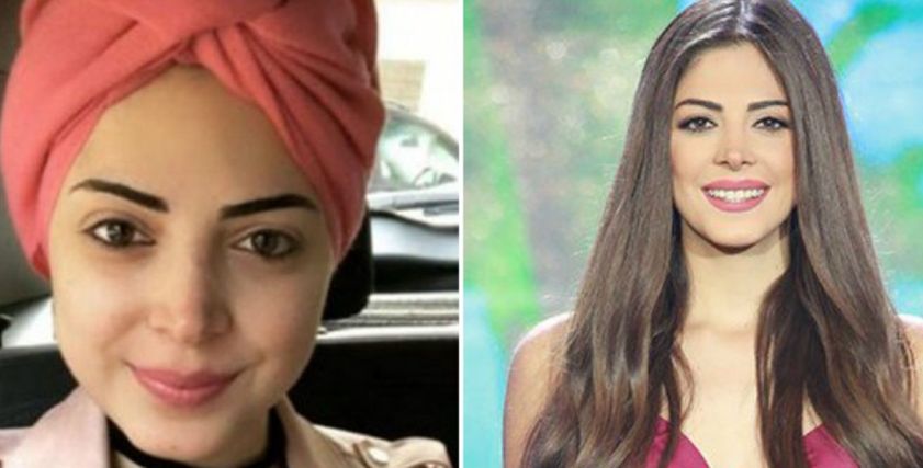  ميشيل حجل