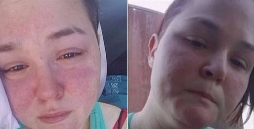الفتاة أمبر فانهيك
