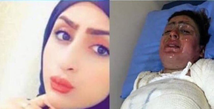 ملاك الزبيدي ضحية العنف الأسري