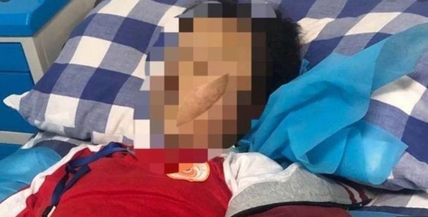 صورة التلميذة داخل المستشفى