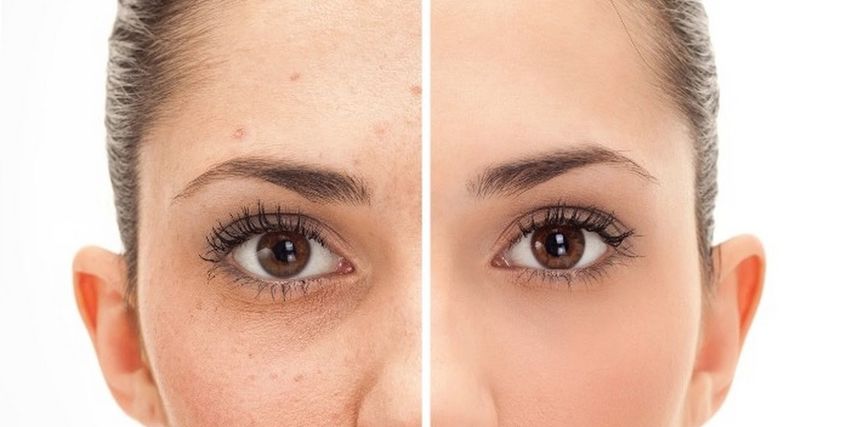 3 اسباب مختلفه سبب فى انتفاخ الوجه غير السمنة