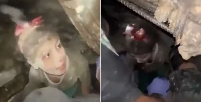الطفلة الفلسطينية ألما