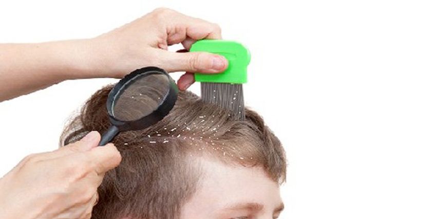 علاج قشرة شعر الطفل