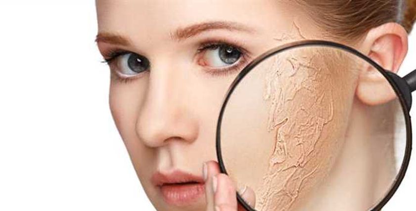 البشرة الجافة