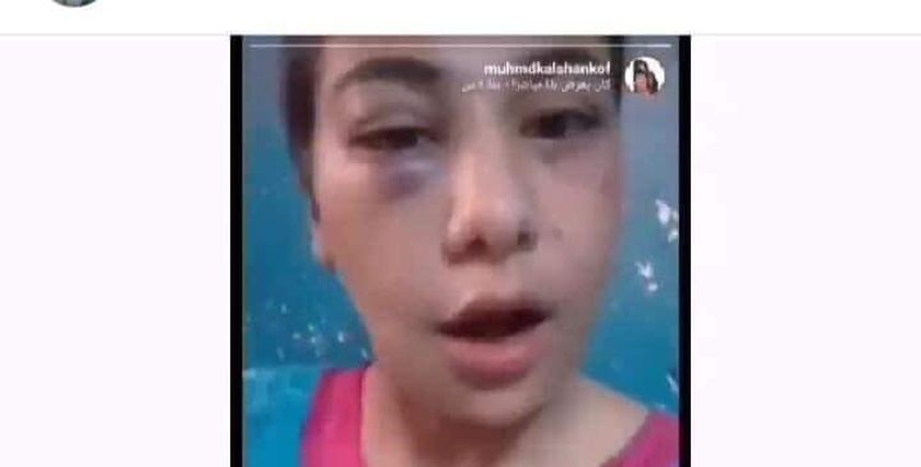 منة عبد العزيز 