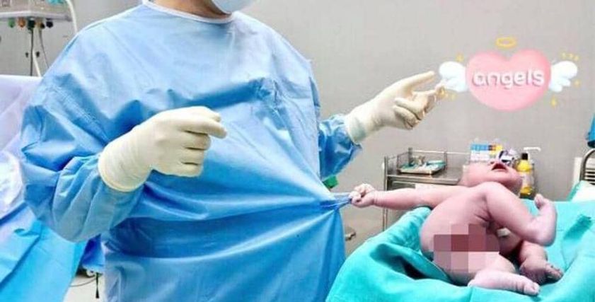 بالصور| «رضيع عنيد» يثير الجدل في فيتنام: «رفض ترك طبيب أخرجه من بطن أمه»