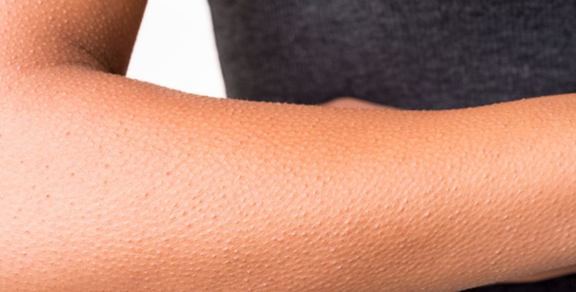 9 نصائح للتخلص من جلد الوزة