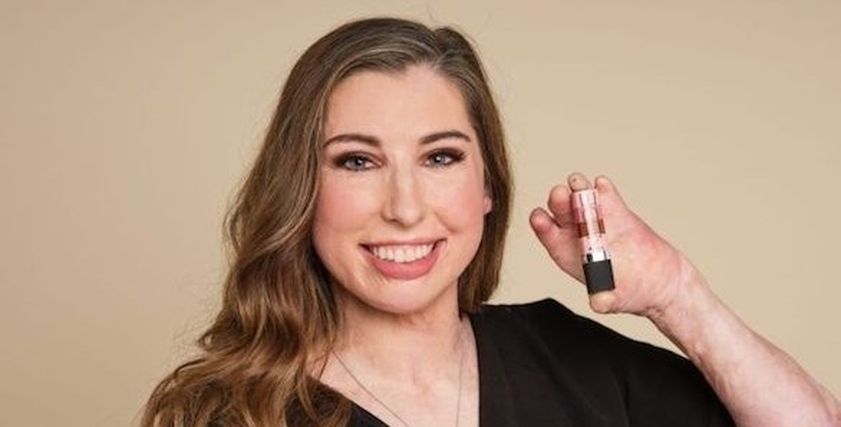 رغم احتراق جسمها تتحول إلى عارضة لمنتجات التجميل