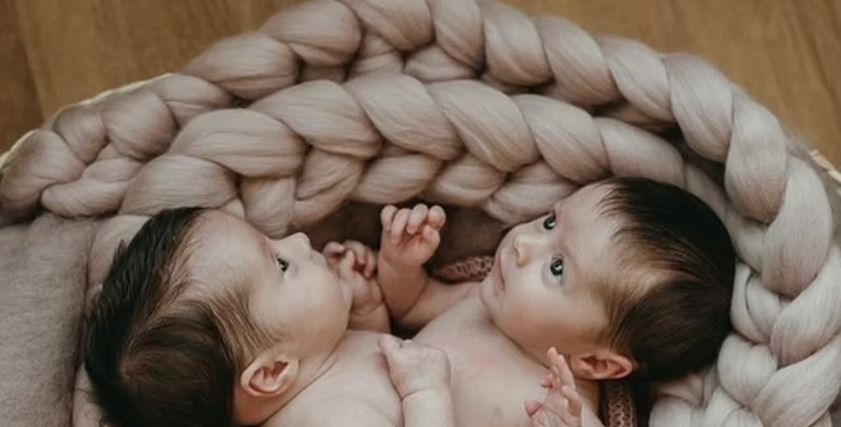 التوأم الملتصق
