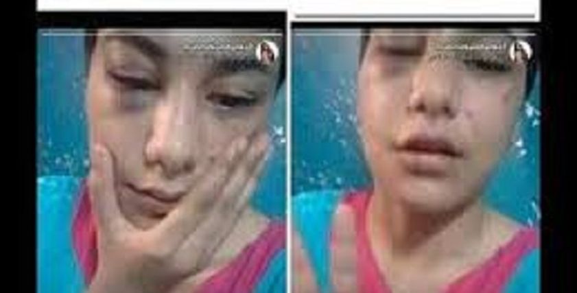 "منة عبد العزيز
