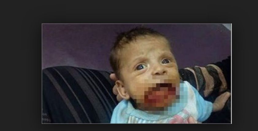 بعد تبنيه.. القصة الكاملة للرضيع