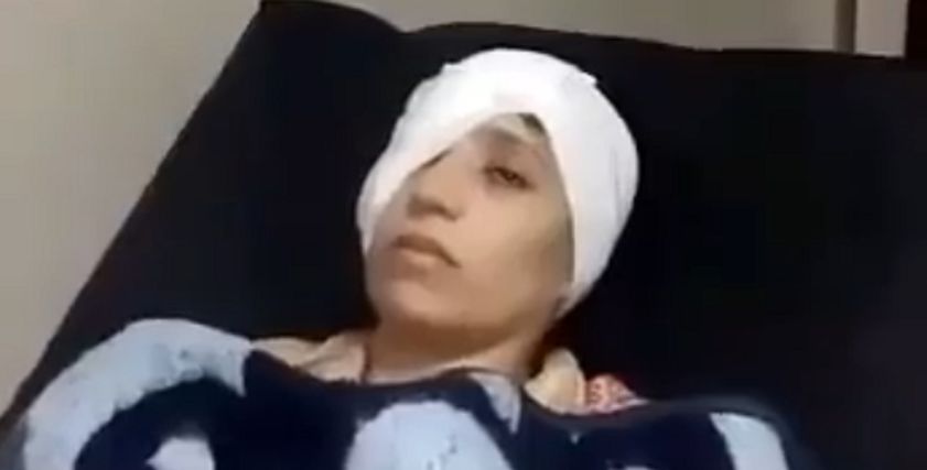 السيدة المسحولة