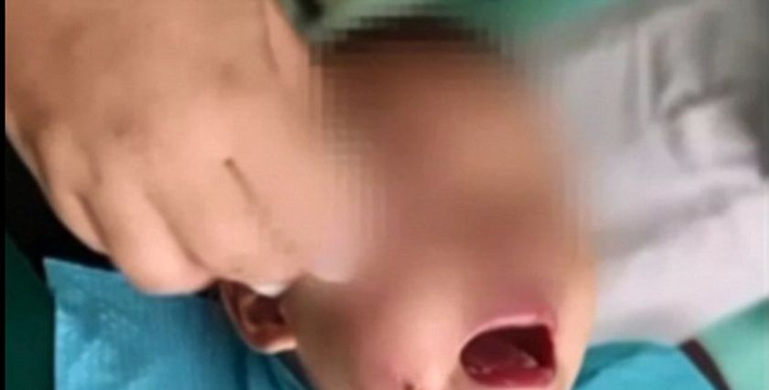 عصا أطعمة مشوية بطول 20 سم تخترق