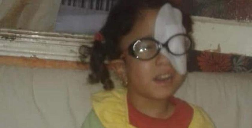 «جنى» الطفلة المصابة