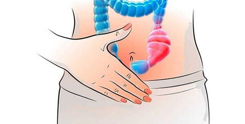 علاج الإمساك المزمن- تعبيرية