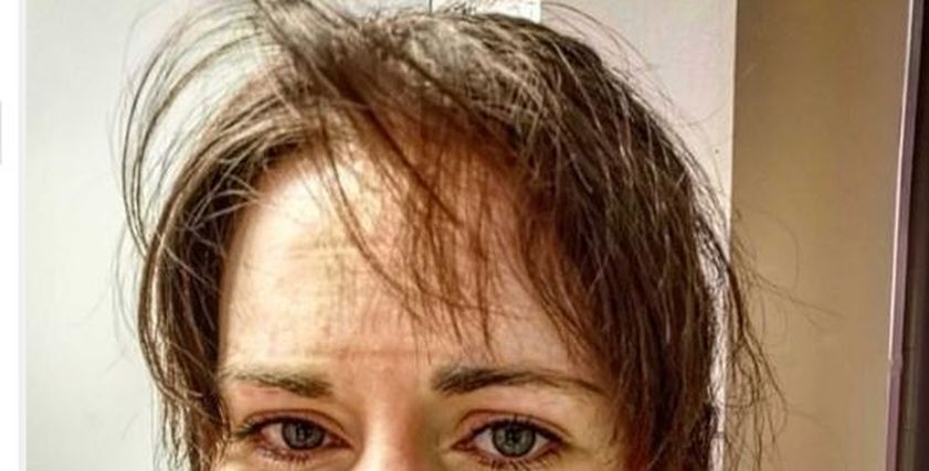 طبيبة تنشر صورة بوجهها تناشد المواطنين البقاء بالمنزل