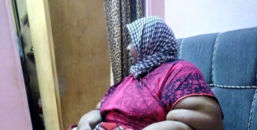صباح مصابة بداء الفيل بالمنصورة