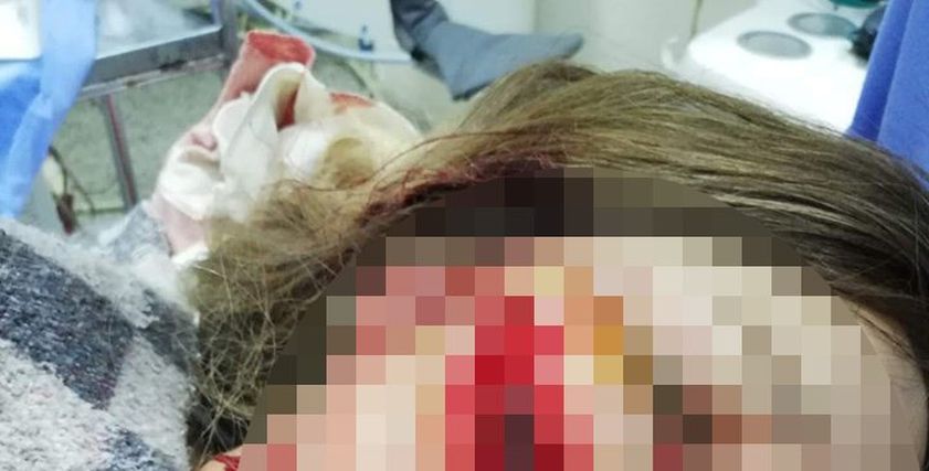 قمر تستنجد بعد تعدي طليق شقيقتها عليها