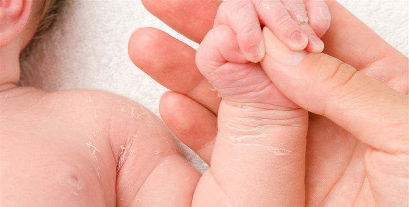 كيفية حماية جلد الأطفال حديثي الولادة