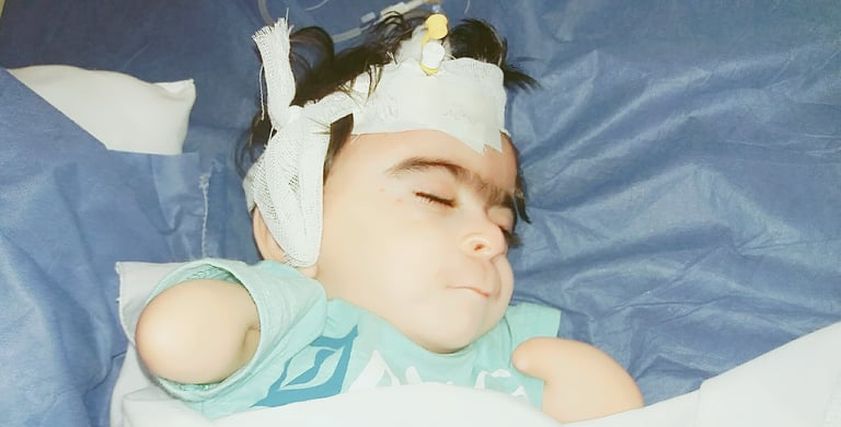 متلازمة نادرة تصيب طفل 3 سنوات