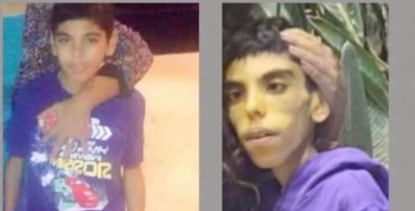 الطفل مصطفى مريض الجهاز الهضمي