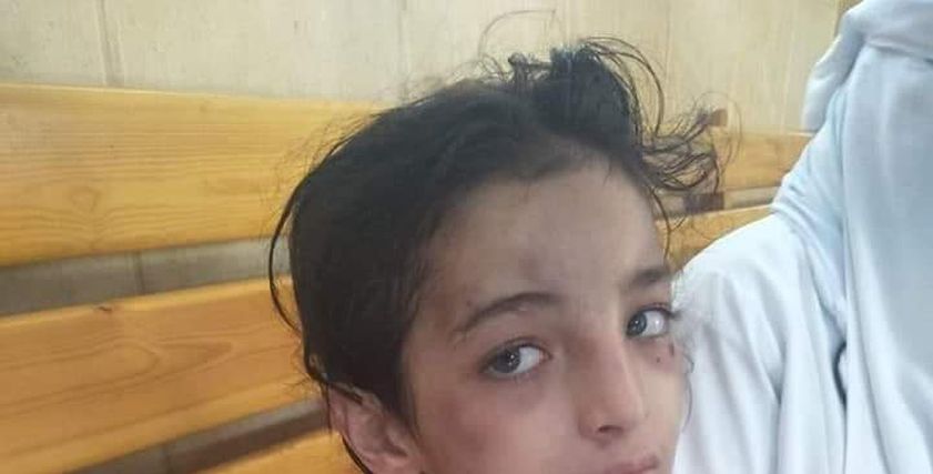 تعذيب الطفلة هبة