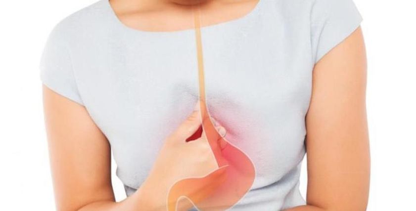 علاج حموضة المعدة