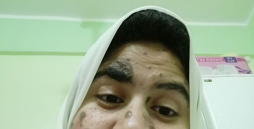 «جهاد» الفتاة المصابة