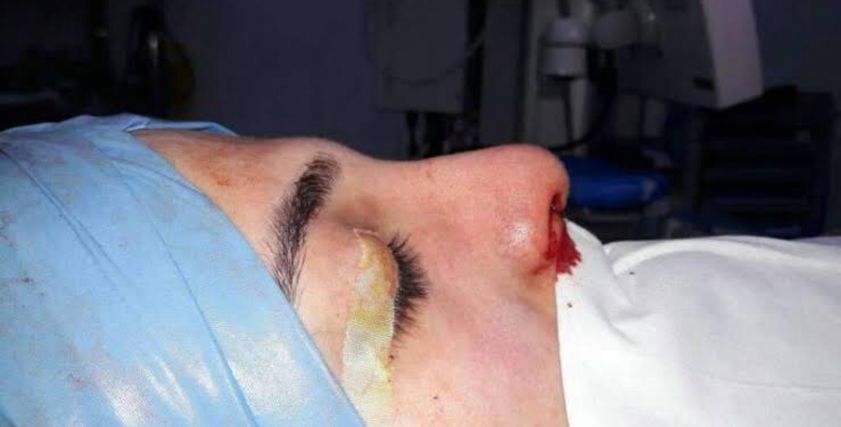 صورة أرشيفية لفتاة داخل احدى عمليات التجميل