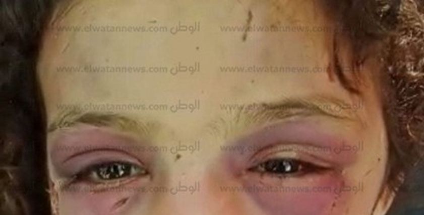 طفلة بلبيس هبة أحمد