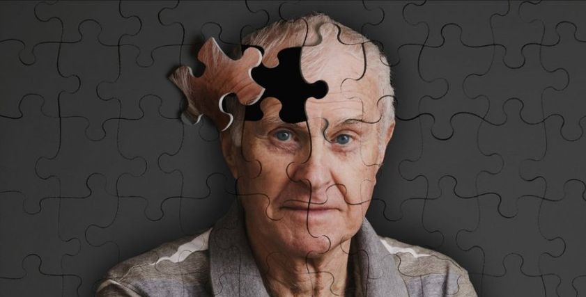 اكتشاف علاج جديد لمرض ألزهايمر