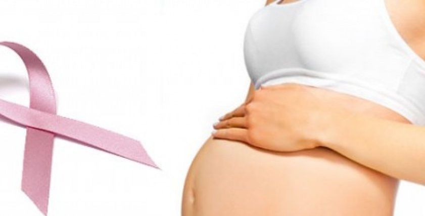 سرطان الثدي