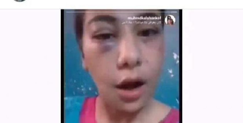 منة عبد العزيز