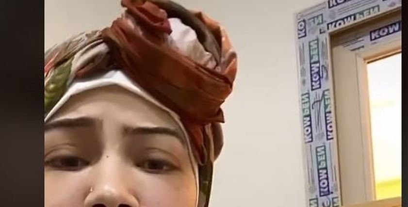 نادين ضحية فيلر الشفايف