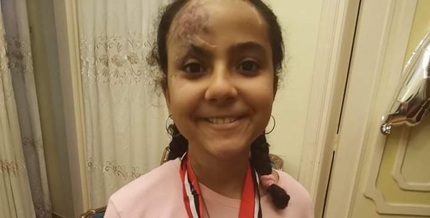 أسيل بطلة كرة السرعة بعد فقدان كف إيديها
