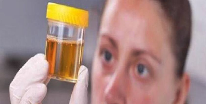 علامات تعرفيها من لون البول