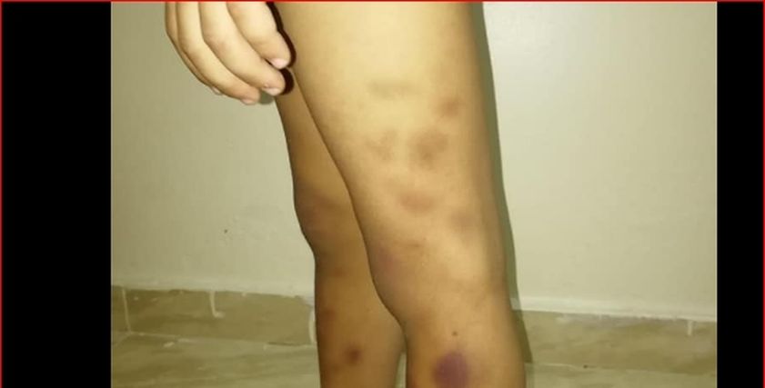 طفل في مرحلة رياض الأطفال في احدى المدارس الخاصة يتعرض لمحاولة التحرش به