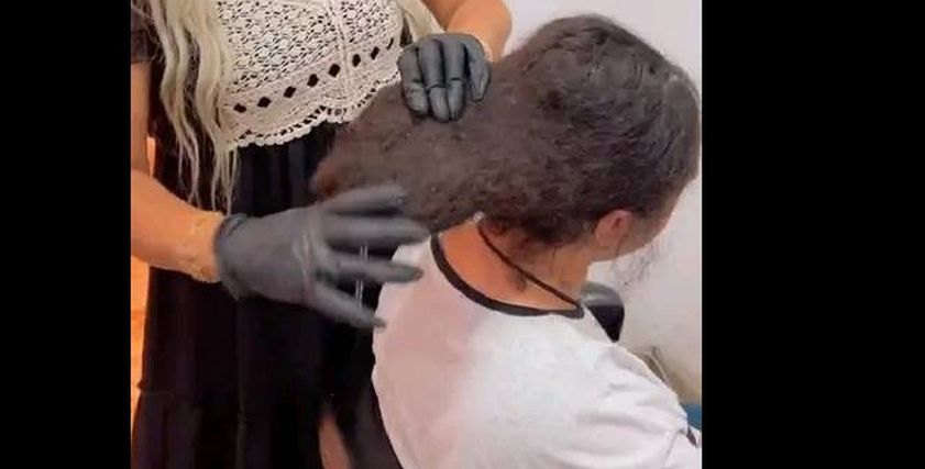 طالبة تعاني من الشعر المتخشب