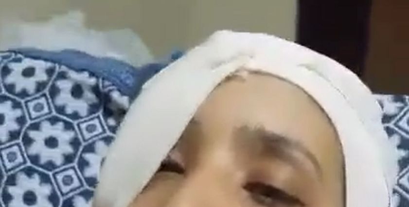 السيدو المسحولة