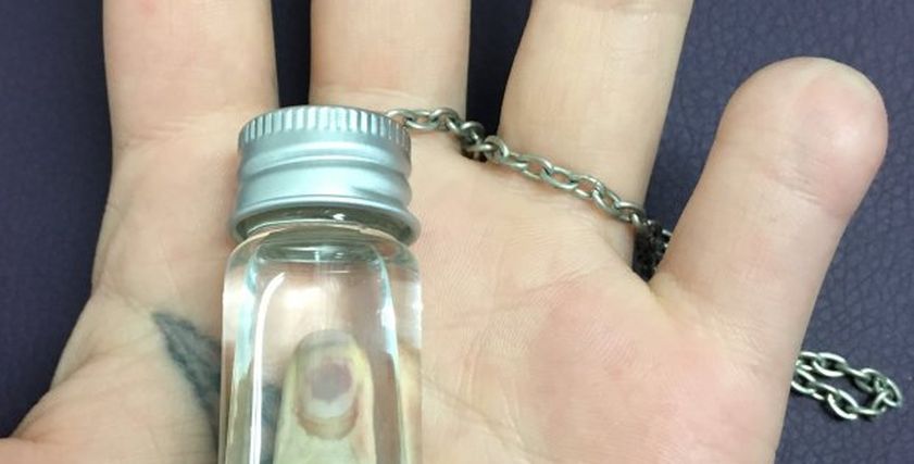 فتاة تقطع أصبعها
