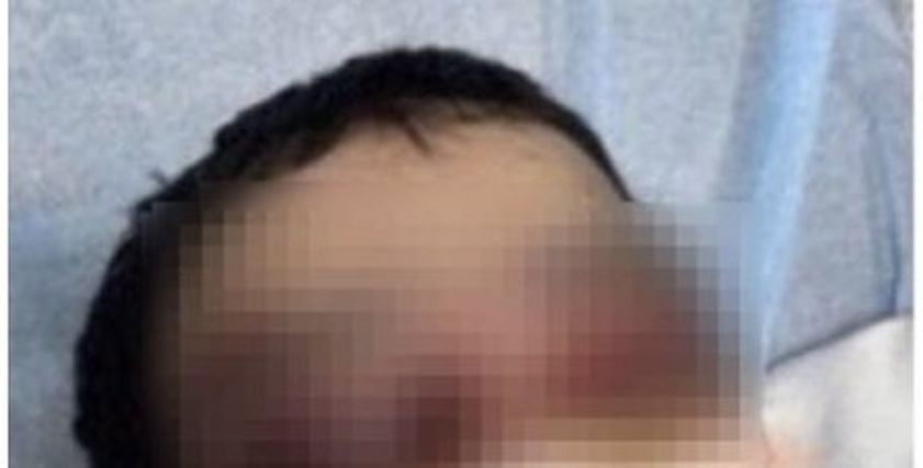 معنفة جدة بعد اعتداء زوجها عليها