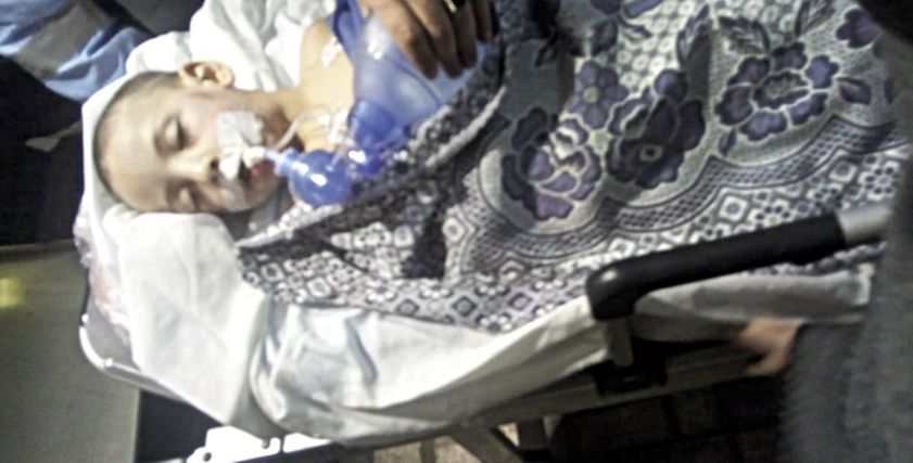 بعد إصابته بنزيف في المخ وكدمات بالجسد.. وفاة الطفل