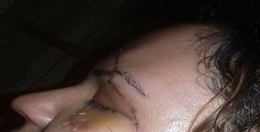 رجل يضرب زوجته بـ