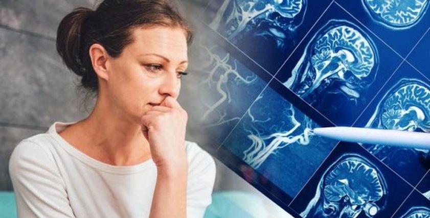 علامات مبكرة تدل على الإصابة بالزهايمر والخرف